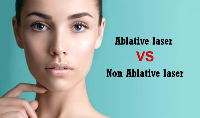 Mitä eroa on ablatiivisessa ja ei -ablatiivisessa laserissa?