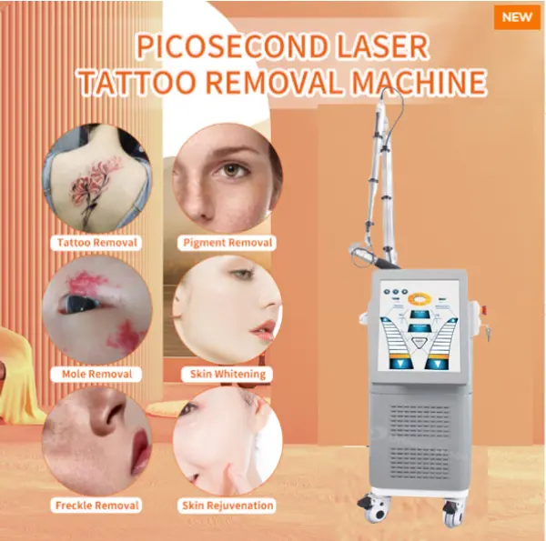 Picosencond Laser --- Kuinka poistaa tatuoinnit tehokkaasti?